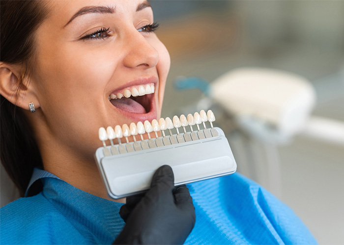Teeth Whitening services
